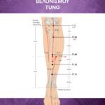 Ατλαντας Βελονισμού TUNG-0